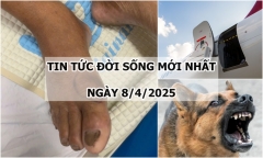 Tin tức đời sống 8/4: 5 người bị chó nghi mắc bệnh dại cắn tại Bà Rịa - Vũng Tàu