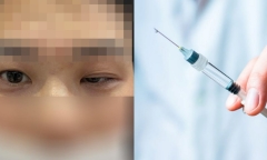 Bi hài hậu vận sau thẩm mỹ: Tiêm botox để thành