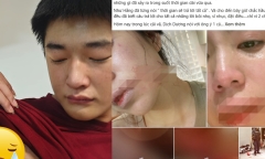 Câu nói xé lòng của Dịch Dương khi thấy Hằng Du Mục bị bố đánh đập dã man