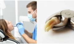 Việc nhổ răng qua từng thời kỳ lịch sử: Thời cổ đại thợ cắt tóc cũng được hành nghề