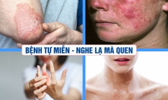 Căn bệnh tự miễn – Nghe lạ mà quen!