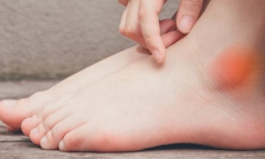 6 dấu hiệu bất thường ở chân cảnh báo thận của bạn đang