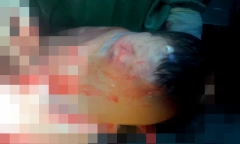 Hà Nội: Bé trai chào đời vẫn trong túi ối, ca sinh hiếm 1/100.000 trường hợp