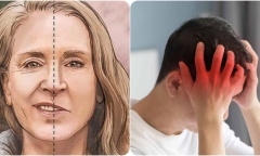 3 điều nên tránh khi xử trí người đột quỵ