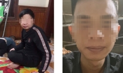Người đàn ông 26 tuổi mắc căn bệnh có tỷ lệ tử vong lên tới 90%