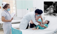 Bé gái 3 tuổi có búi tóc dài, cứng trong dạ dày