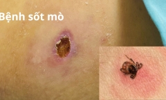 Cảnh báo với 