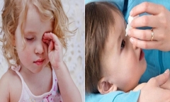 Số ca đau mắt đỏ tăng nhanh, TP.HCM nhanh chóng xác định tác nhân gây bệnh