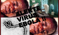 Đại dịch Ebola bắt nguồn từ bé 2 tuổi ở Guinea?