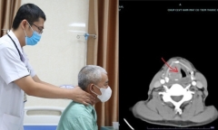 Người đàn ông gặp họa sau khi tự uống thuốc nam chữa ung thư
