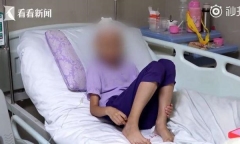 Bé gái 8 tuổi phải phẫu thuật não, nguyên nhân xuất phát từ bệnh răng miệng quen thuộc
