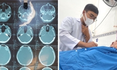 Bất ngờ bị tủ hồ sơ đè, 4 người phải nhập viện cấp cứu vì đa chấn thương