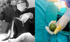 Cứu sống nam thanh niên ngoại quốc nhét lươn, chanh vào hậu môn