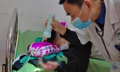Điện thoại phát nổ khi sạc pin, nam sinh bị dập nát bàn tay