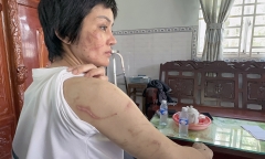 Thông tin nóng vụ vợ mang bầu 7 tháng