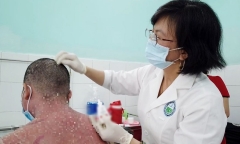 Người đàn ông nhập viện sau khi sử dụng thuốc chữa vảy nến quảng cáo trên mạng