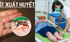 Tự mua thuốc điều trị sốt xuất huyết, người đàn ông suýt 