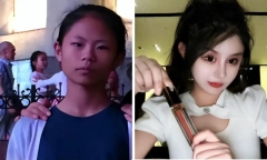 Phẫu thuật 