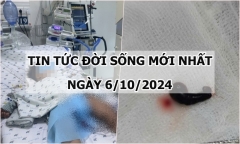 Tin tức đời sống 6/10/2024: Hãi hùng phát hiện vắt rừng còn sống trong mũi