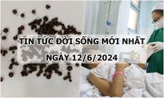 Tin tức đời sống ngày 12/6/2024: Hơn 200 viên sỏi lấp đầy túi mật bệnh nhân