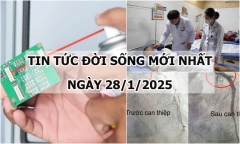 Tin tức đời sống 28/1: Nguyên nhân khiến thanh niên đau hông, dáng đi bất thường