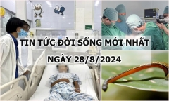 Tin tức đời sống 28/8/2024: Kinh hoàng phát hiện con vắt “tạm trú” trong mũi