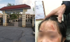Vụ nữ sinh lớp 6 bị bạn bạo hành 