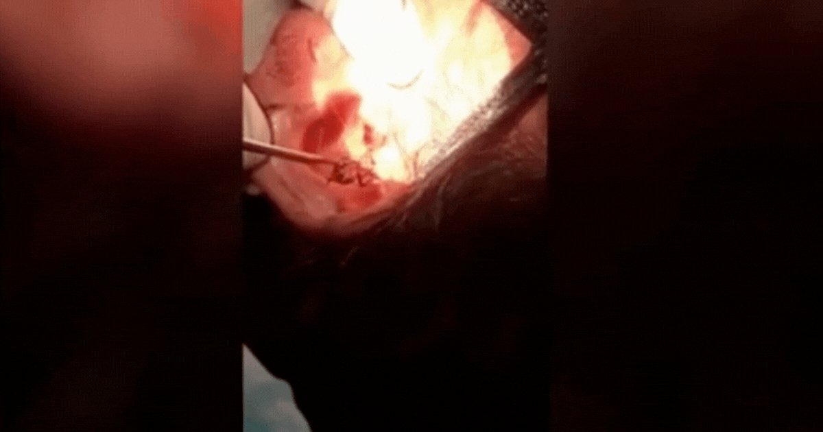 Video: Bác sĩ sốc khi phát hiện thứ 