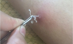 Rùng mình: Giun rồng dài hơn 10cm 