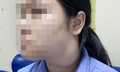 Nhập viện gấp vì tin tưởng phòng khám tư nhân chích nang “lạ”