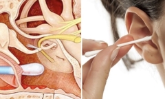 Tại sao không nên lấy ráy tai bằng tăm bông?