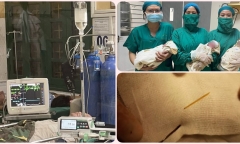 Tin tức đời sống mới nhất ngày 27/8: Nguyên nhân khiến bé trai 6 tuổi đau bụng dữ dội 