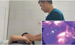Không sử dụng khí trong “bóng cười” trên bệnh nhân khi chưa được Bộ Y tế phê duyệt