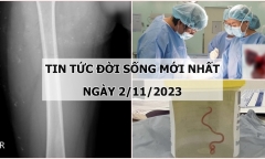 Tin tức đời sống mới nhất ngày 2/11: Giật mình phát hiện giun dài 8cm ký sinh trong não người phụ nữ