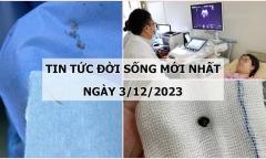 Tin tức đời sống mới nhất ngày 3/12: Mảnh đạn găm trong vùng hàm mặt người đàn ông 56 năm