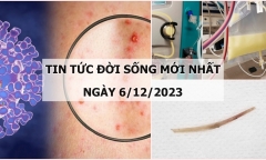 Tin tức đời sống mới nhất ngày 6/12: Tiền Giang ghi nhận trường hợp mắc đậu mùa khỉ đầu tiên