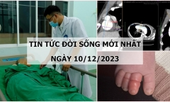 Tin tức đời sống mới nhất ngày 10/12: Cụ bà bị trúng “đạn lạc” khi đang lượm cà phê