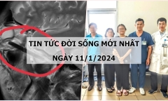 Tin tức đời sống mới nhất ngày 11/1: Phát hiện đoạn đũa gỗ dài 6m trong hốc mắt người đàn ông