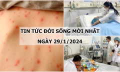 Tin tức đời sống mới nhất ngày 29/1: Bé gái 4 tuổi nguy kịch do mắc bệnh thủy đậu
