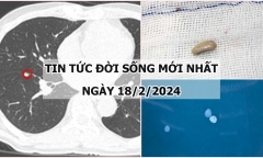 Tin tức đời sống mới nhất ngày 18/2: Sút 4kg/tuần, đi khám phát hiện mắc 2 bệnh ung thư 