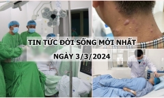 Tin tức đời sống mới nhất ngày 3/3: Kích hoạt báo động đỏ cứu bệnh nhân chấn thượng sọ não nặng