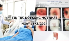 Tin tức đời sống ngày 15/3: Cứu kịp thời thai phụ trẻ bị thoát vị hoành bẩm sinh hiếm gặp