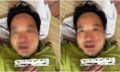 Trạm trưởng kiểm lâm tại Thanh Hóa bị xe tải đâm, công an vào cuộc làm rõ