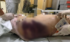 Vụ bé gái 8 tuổi nghi bị 