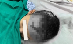 Tin tức đời sống ngày 28/4: Bé trai 2 tuổi nhập viện vì bị chó nhà tấn công