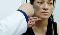 Mẹ trẻ khóc nghẹn nhìn khuôn mặt sau nhiều năm không dám tháo khẩu trang nơi công cộng