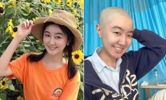 Ngôi sao nhí được yêu thích nhất Trung Quốc phẫu thuật u não thành công
