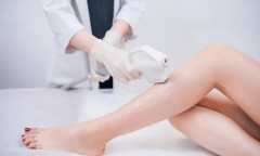 Có nên triệt lông bằng laser không? 