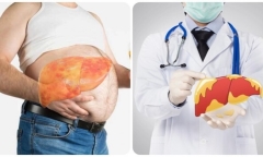 Dấu hiệu cảnh báo gan đang 