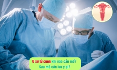U xơ tử cung khi nào cần mổ? Sau mổ cần lưu ý gì?